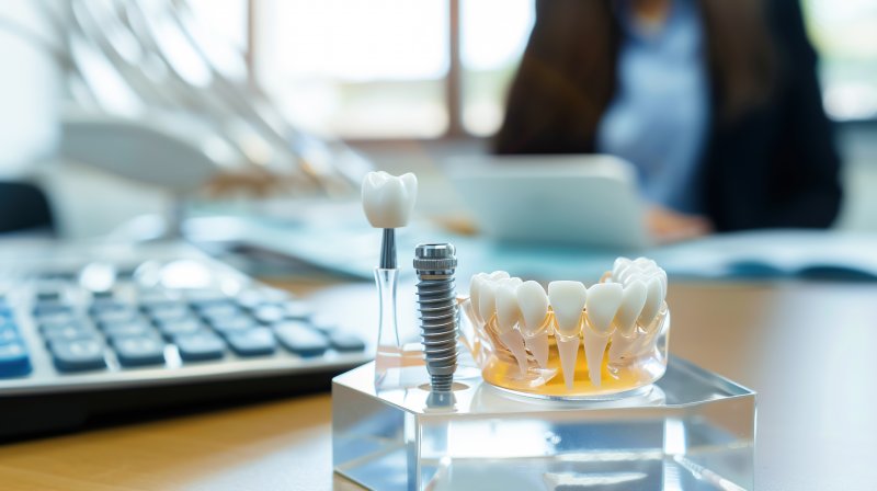 dental implant and calculator